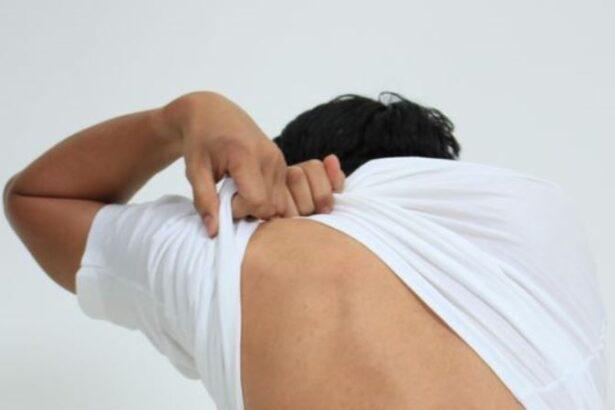 Macam Penyakit Kulit