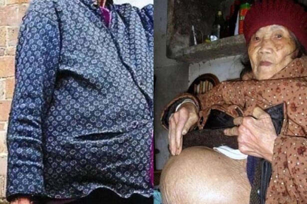 Viral Nenek 91 Tahun Hamil