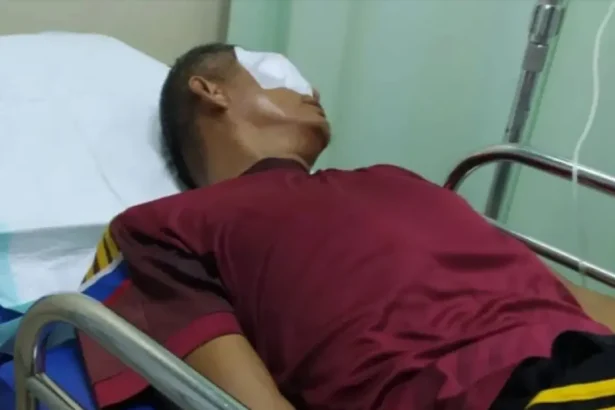 Guru Hampir Buta Diketapel Orangtua Murid