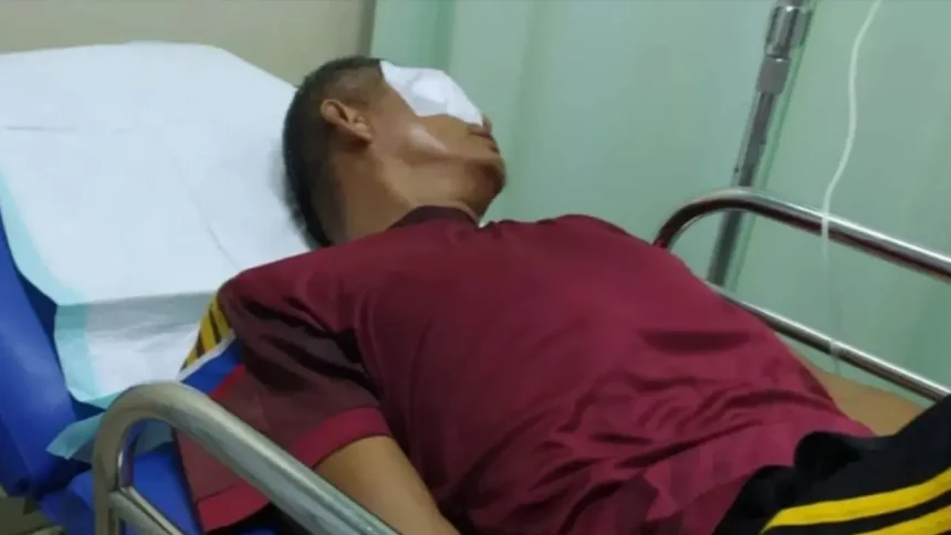Guru Hampir Buta Diketapel Orangtua Murid
