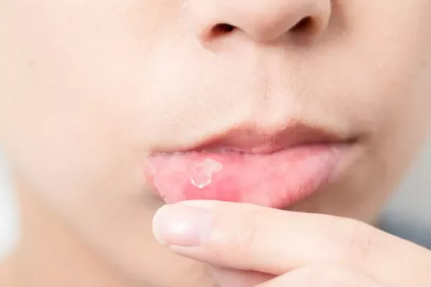 018d1ca3 6fb6 4b0b 86d0 83c6399068a5 Article Image Url