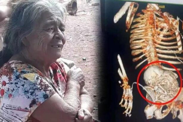 Ada Janin Di Perutnya Setelah 50 Tahun