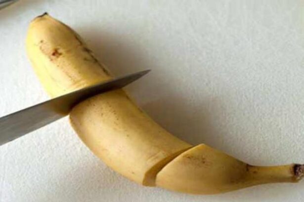 Ilustrasi potong kelamin