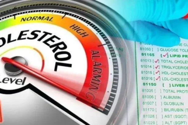 Ciri-Ciri Kolesterol Tinggi