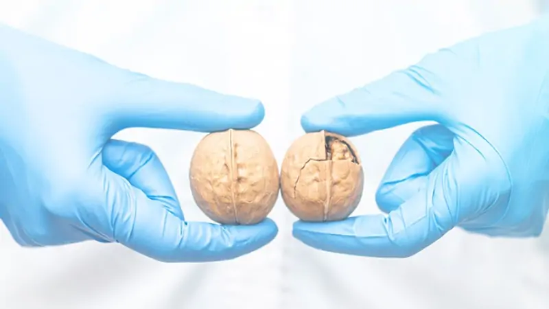 Ilustrasi Tumor Testis