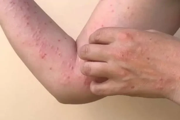 Images 2024 09 17t203124.145