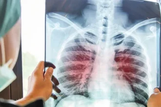10 Penyakit Paling Mematikan