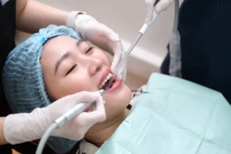 Ilustrasi Scaling Gigi