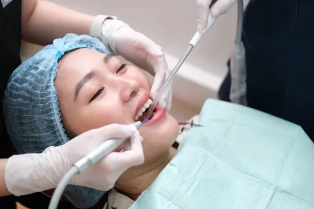 Ilustrasi Scaling Gigi