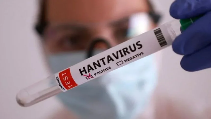 Gejala Hantavirus